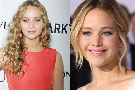 Has Jennifer Lawrence Had Cosmetic Surgery