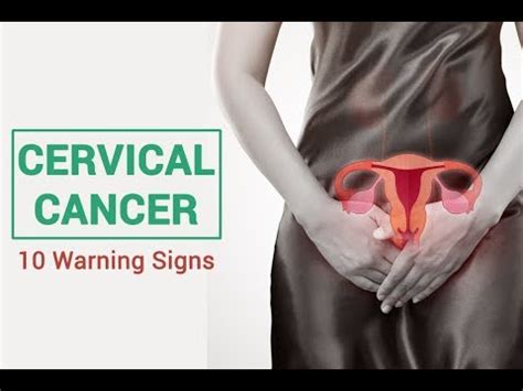 The cervix is a neck of tissue similar in shape to a cylinder that attaches the uterus to the vagina. 10 warning signs and symptoms of Cervical Cancer || Self ...