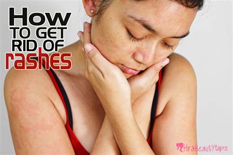 How To Get Rid Of Rashes Fast At Home Beauty Tips Guws Medical