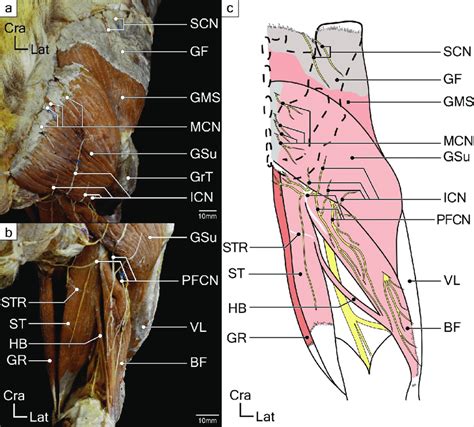 Superficial Layer Muscles Of Gluteal And Posterior Femoral Regions In A