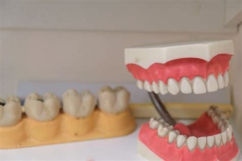 Dentures Vs Veneers The Differences Explained