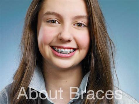 Northside Orthodontics Braces Invisalign In Roswell Alpharetta Johns