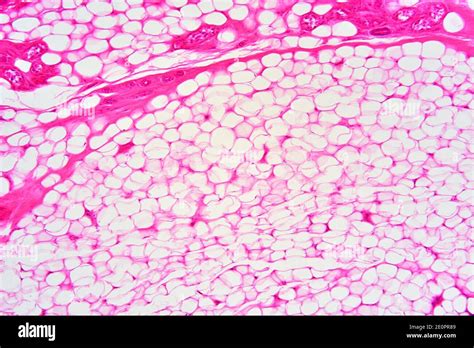 Adipose Tissue Hi Res Stock Photography And Images Alamy
