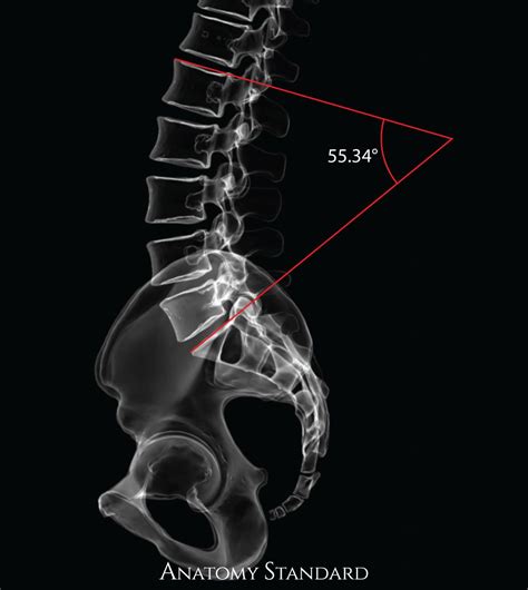 Pin On Sagittal Alignment Of The Spine