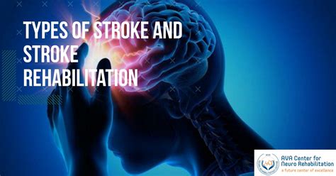 Types Of Stroke And Stroke Rehabilitation