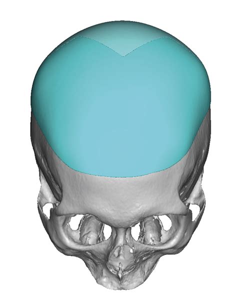 The Basic Concepts Of The Two Stage 3d Skull Implant Augmentation