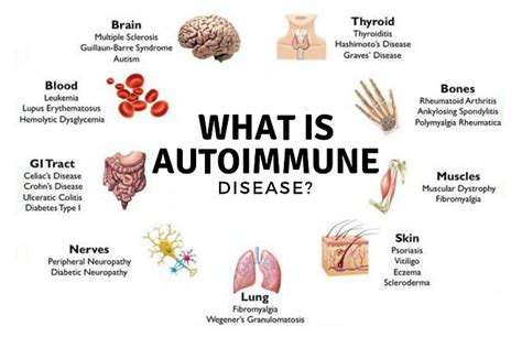 Autoimmune Disease Nutrition How It Can Save Your Life