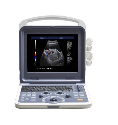 Ultrasonic Diagnostic Apparatus Portable Cardiac 3d4d All In One Color