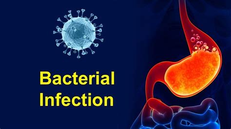 Bacterial Infection Causes And Common Symptoms For How To Prevent This Bacterial