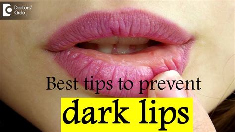 How To Lighten Dark Lips Permanently Dr Rajdeep Mysore Youtube