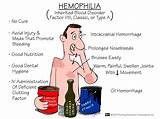 Hemophilia Disease Treatment Pictures