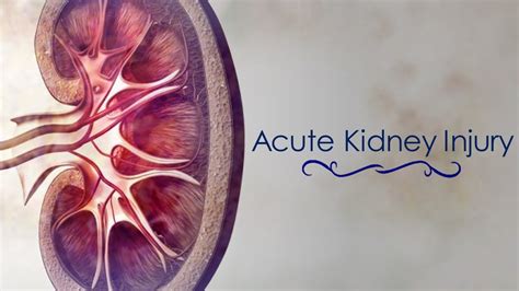 Acute Renal Failure Acute Kidney Injury Youtube