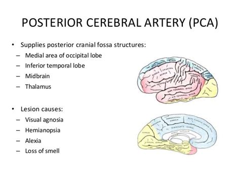 Right Posterior Cerebral Artery Pca And Cerebellar Infarction 987
