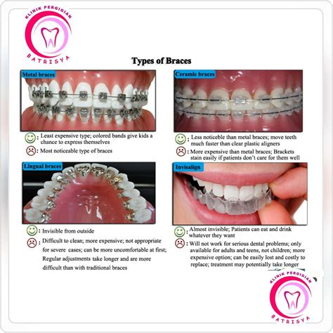 Jenis Jenis Braces Pendakap Klinik Pergigian Batrisya