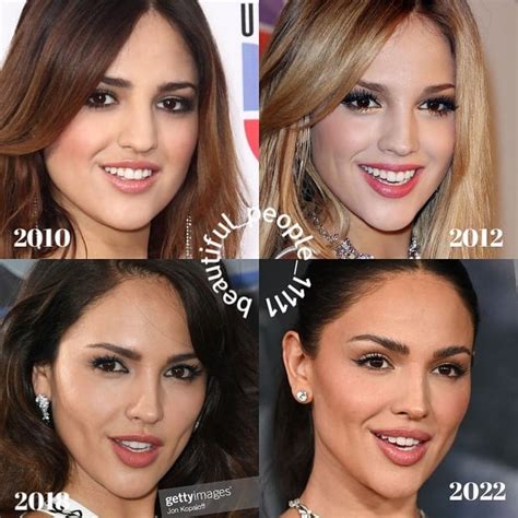 Rate Eiza Gonzalez Before And After Plastic Surgery Rvindictaratecelebs