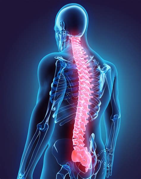 척수손상spinal Cord Injury Sci 네이버 블로그