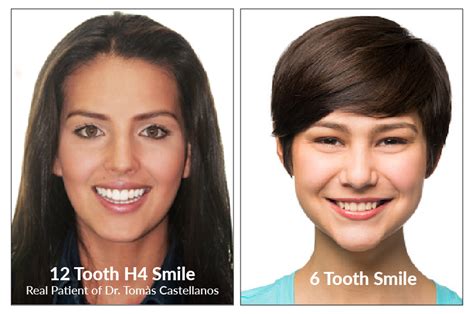 Advanced Orthodontics In Rocklin Ca Damon System