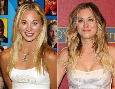 Kaley Cuoco Before After Breast Implants