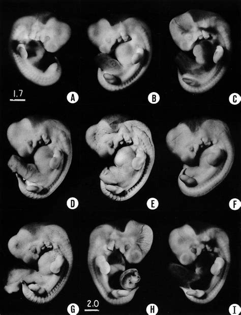 Developmental Stages In Human Embryos