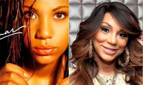 Tamar Braxton Plastic Surgery Allegations Partially Confirmed