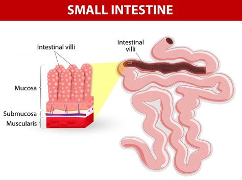 What Are The Different Types Of Intestine Diseases