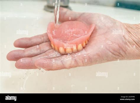 Asian Senior Or Elderly Old Woman Patient Holding Partial Denture Of