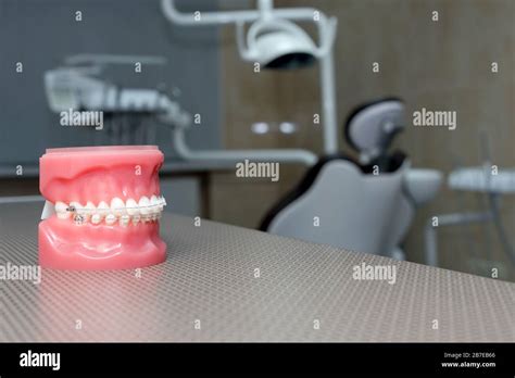 Orthodontic Model And Dentist Tool Demonstration Teeth Model Of