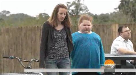 Insurance Will Now Pay For Gastric Bypass For Morbidly Obese Girl With
