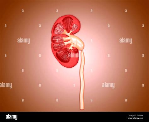 Ureteropelvic Junction Upj Obstruction In The Kidney Stock Photo Alamy