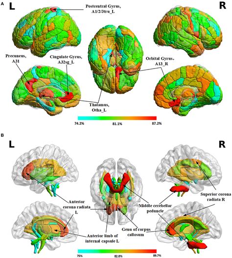 Frontiers Brain Differences Between Men And Women Evidence From Deep Learning Neuroscience