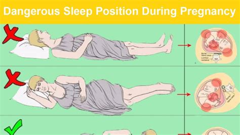 Best Sleep Position During Pregnancy YouTube