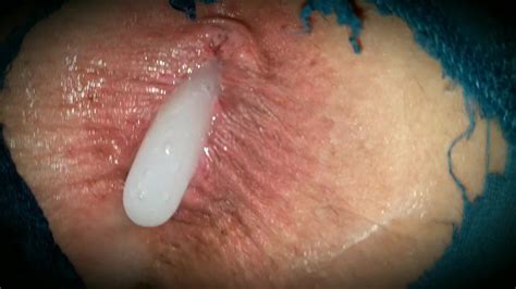 Pulling Out My Anal Plug For A Huge Creampie Cum Fart