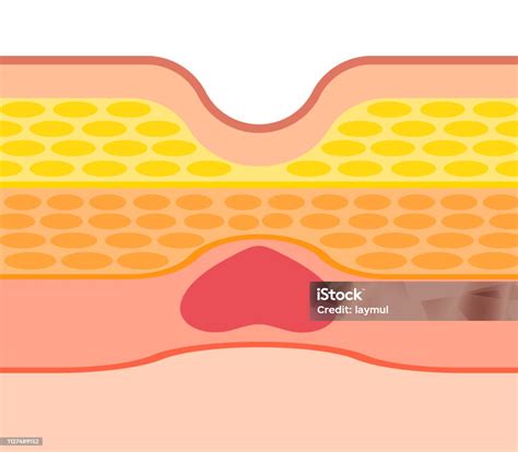 The Structure Of The Navel Stock Illustration Download Image Now Belly Button Cross Section