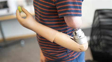 Prosthetic Arm Enables Patients To Feel The Objects They Grip Stat