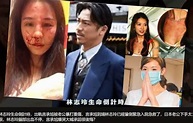 林志玲再传被家暴，疑因无法怀孕感情破裂，网友：非要嫁给外国人_腾讯新闻