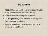 Chronic Myeloid Leukemia Treatment Drugs