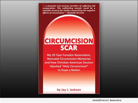 New Book ‘circumcision Scar Is A Memoir Revealing How The Worlds Oldest Religious Sacrifice