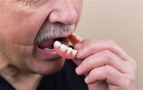 The Most Common Reasons For Tooth Loss In Adults Your Dental Health