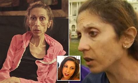 Anorexic Actress Rachael Farrokh Who Nearly Died Makes A Remarkable
