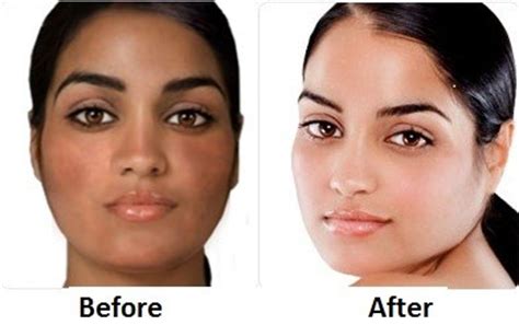 How To Reduce Melanin Naturally Permanently At Home