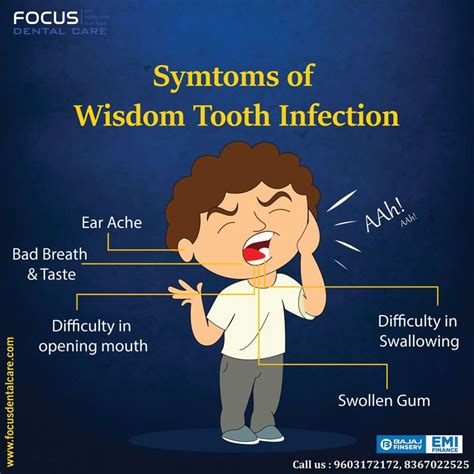 Wisdom Tooth Extraction In Hyderabad Tooth Infection Wisdom Teeth