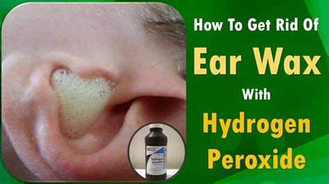 Hydrogen Peroxide Can Remove Ear Wax And Clear Ear Infections How To