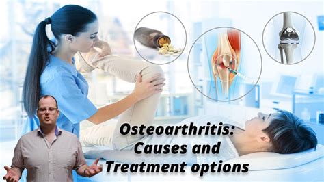 Osteoarthritis Causes And Treatment Options Youtube