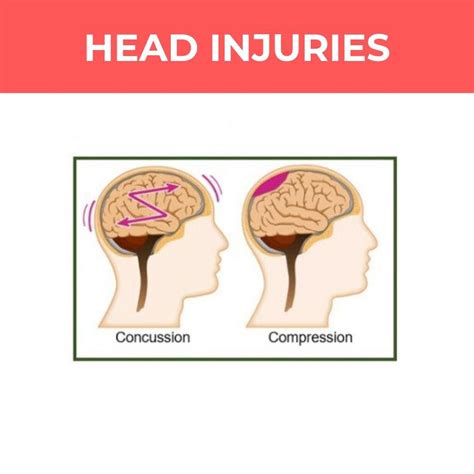At A Basic First Aid Level Head Injuries Can Be Broadly Split Into Two