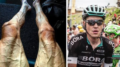 Tour De France Cyclist Shows Off Bulging Veins In His Legs Signals From A Nearby Star