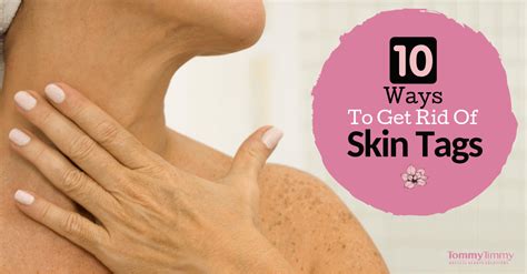 10 ways to get rid of skin tags ~ sue hawthorne skincare
