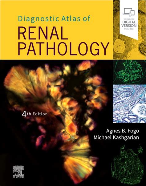 Diagnostic Atlas Of Renal Pathology 4th Edition Сити Център Варна