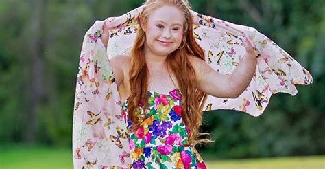 Teen Model With Down Syndrome Lands Two New Campaigns Free Nude Porn Photos
