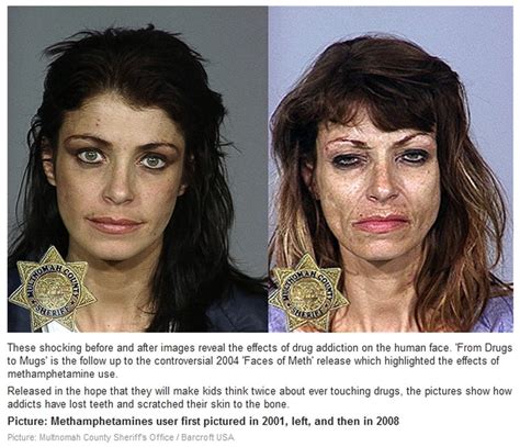 Methamphetamine Before And After