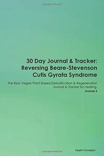 30 Day Journal And Tracker Reversing Beare Stevenson Cutis Gyrata